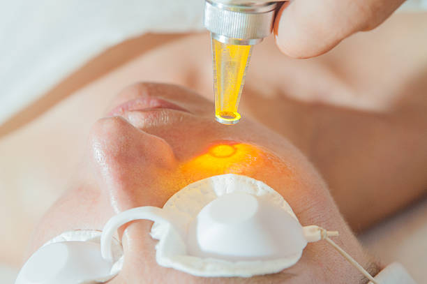 Yellow Laser Treatment Guide for Skin and Redness Concerns